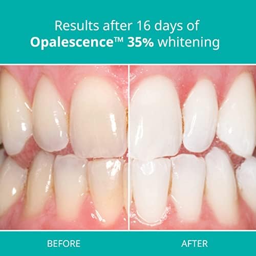 Evde Opalescence Diş Beyazlatma-Diş Beyazlatma Jeli Şırıngaları-8 Paket %35 Şırınga-Nane