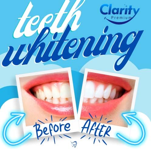 Clarity Premium Diş Beyazlatma Şeritleri - Diş Beyazlatma için 28 Beyaz Şerit-Diş Beyazlatma Şeridi - 14 Diş Beyazlatma Tedavisi -